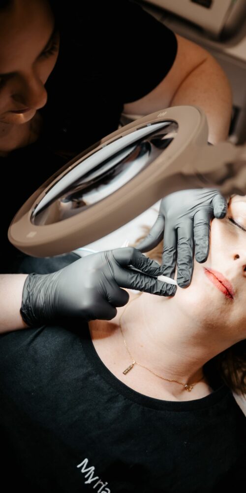 épilation définitive