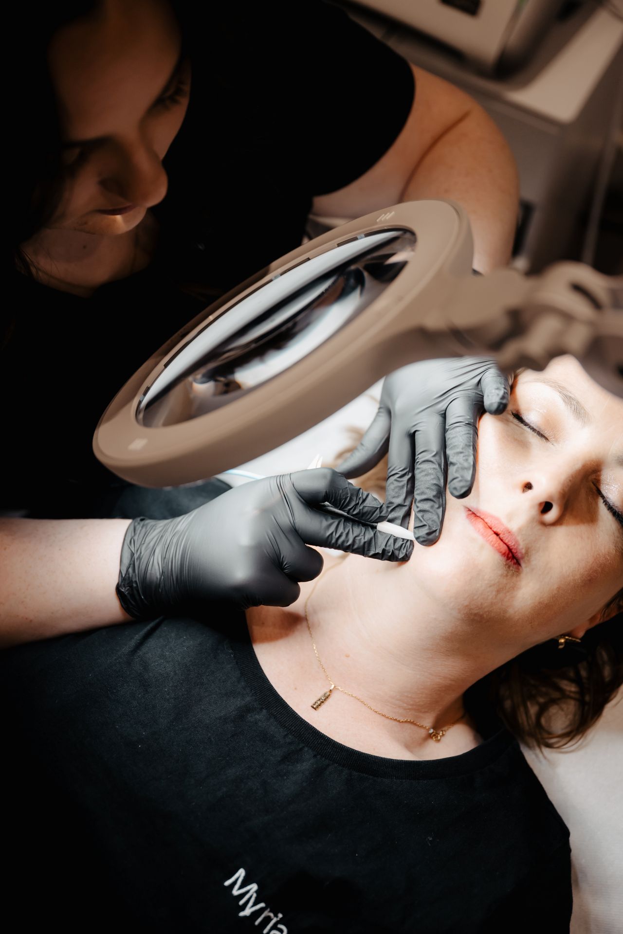 épilation définitive